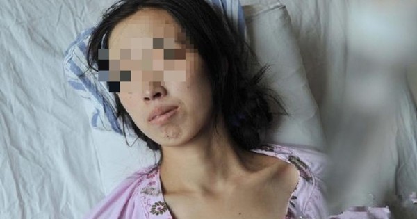 Đi khám vì khó tiêu, người phụ nữ phát hiện ung thư gan: BS hoảng hốt: "Ai lại ăn sáng kiểu này suốt 20 năm?"