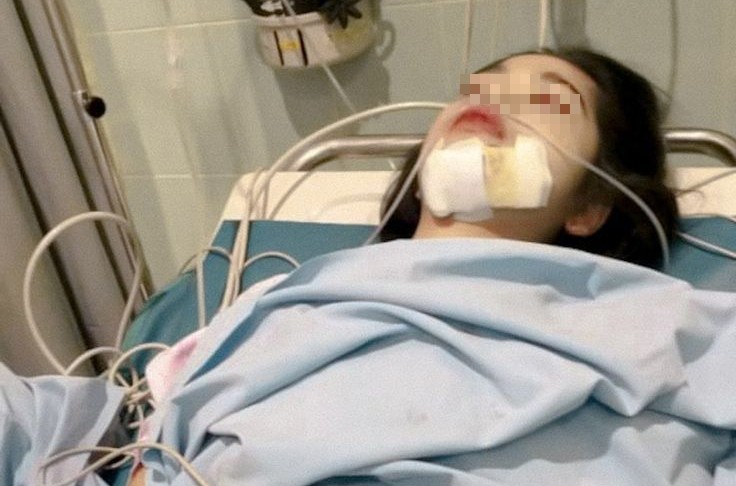 Ngày càng nhiều người chết vì ung thư vòm họng? Bác sĩ cảnh báo: Có 5 nhóm người bị liệt vào danh sách "RỦI RO CAO"