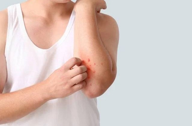 Người đàn ông 40 tuổi phát hiện ung thư gan giai đoạn cuối: Đáng tiếc ông đã bỏ qua dấu hiệu suốt 3 tháng