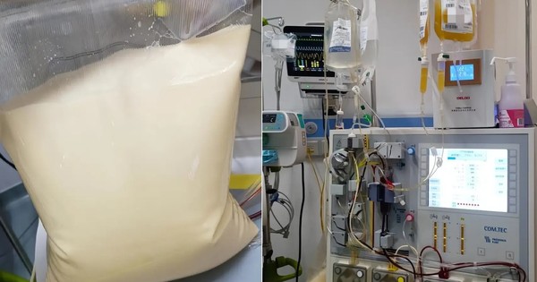 25 tuổi, máu chuyển trắng như sữa, cùng lúc mắc 3 bệnh nguy kịch: Bác sĩ cảnh báo lối sống này đang âm thầm “bôi mỡ” vào máu người trẻ