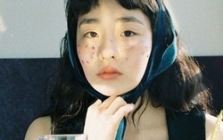 Các bác sĩ khuyên: Không cần chờ tới lúc ngứa da, thấy 7 dấu hiệu này trên mặt tức là máu đã "ngập đường"